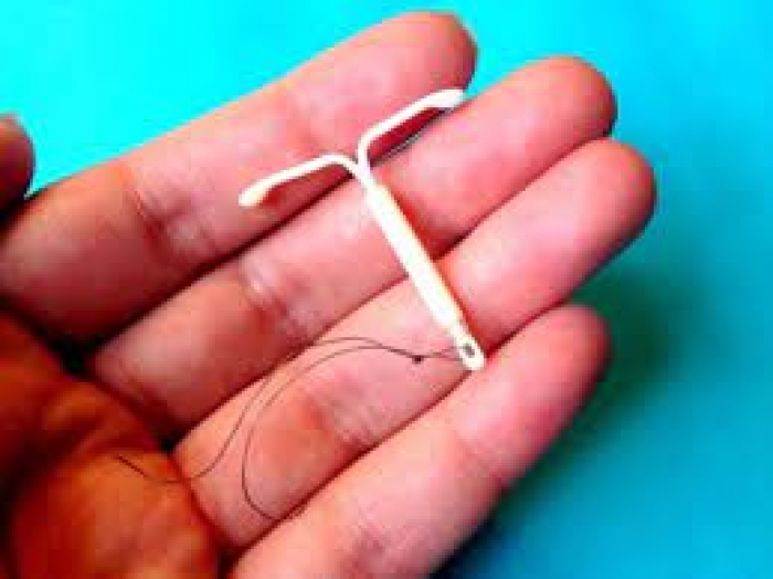 Senadora contesta exigência de autorização do marido para uso de DIU